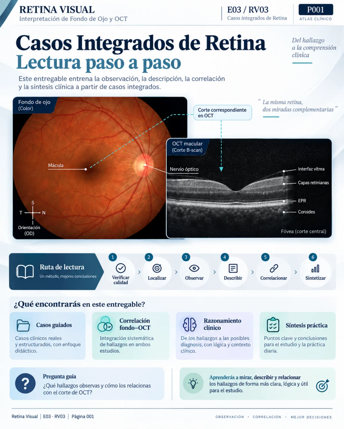 Muestra del material de Retina: Casos Integrados · página 1.