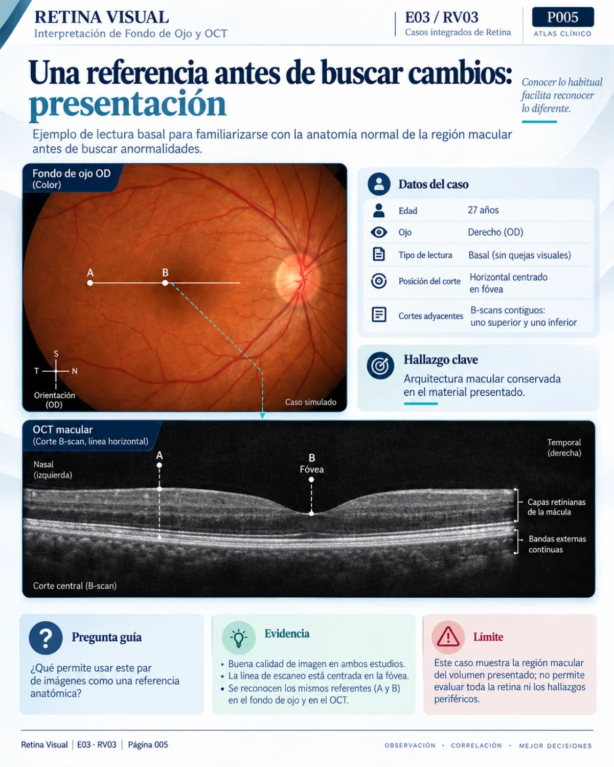 Muestra del material de Retina: Casos Integrados · página 5.