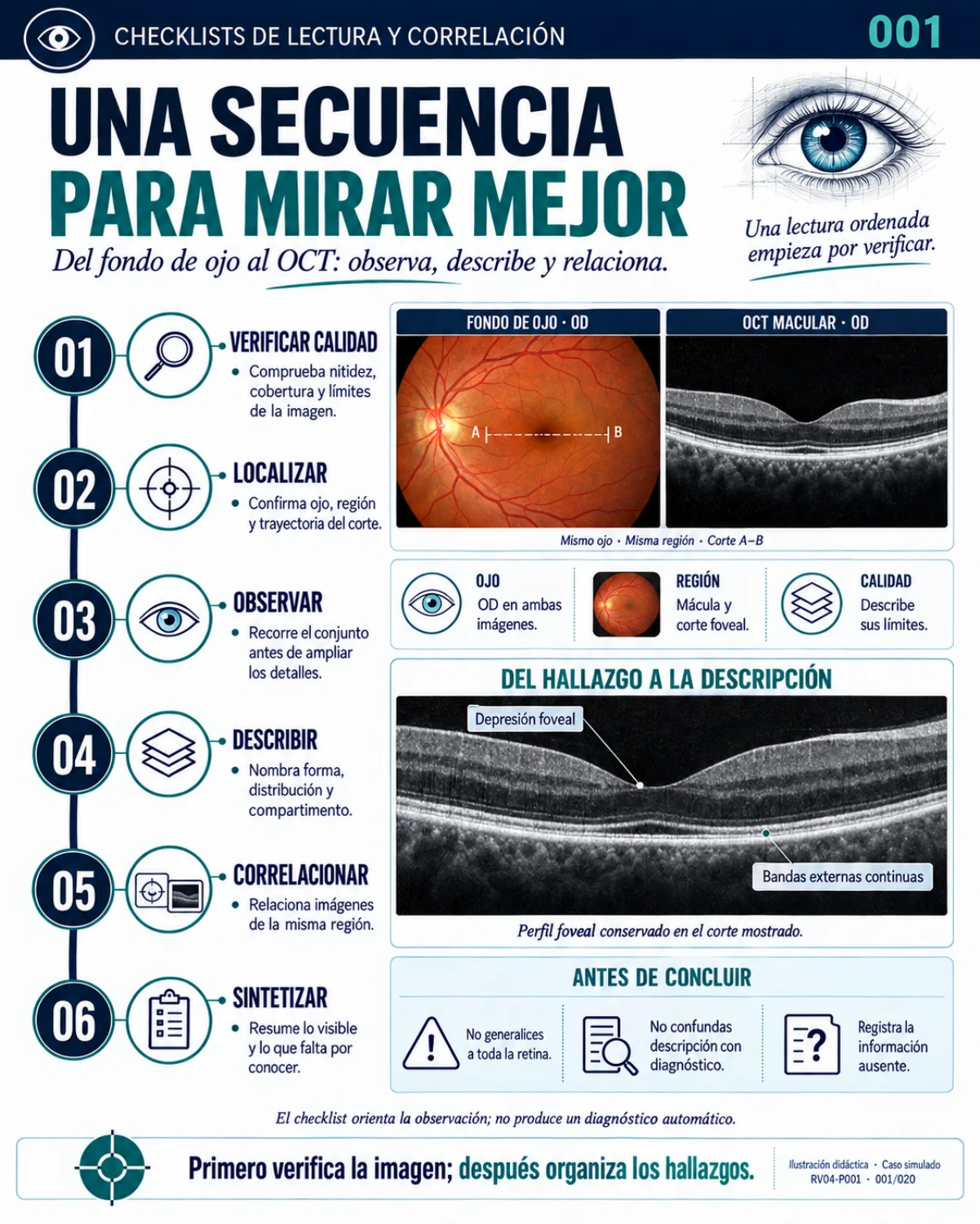Muestra del material de Retina: Checklists · secuencia de lectura.